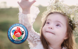 21 mart down sendromu