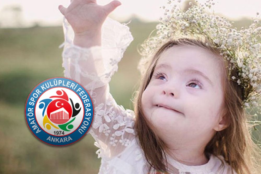 21 mart down sendromu